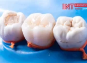 Penafsiran Unik: Arti Mimpi Mencabut Gigi Sendiri Ternyata Ini Artinya Menurut Pakar