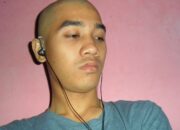 Buka Mata! Arti Mimpi Botak Menurut Islam : Ini Penjelasannya