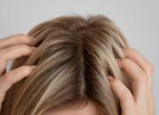 Penafsiran Unik: Arti Mimpi Banyak Kutu Di Kepala : Ini Penjelasannya