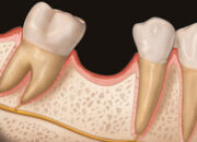 Tabir Terbuka:Rahasia Tersembunyi: Arti Mimpi Gigi Geraham Atas Copot Ternyata Ini Artinya Menurut Pakar