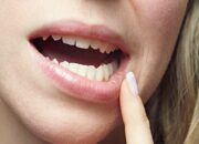 Simak! Arti Mimpi Gigi Patah Bagian Atas Ternyata Ini Artinya Menurut Pakar