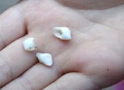 Misteri Terungkap: Arti Mimpi Gigi Patah : Ini Penjelasannya