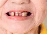 Kisah di Balik Arti Mimpi Gigi Goyang Bagian Bawah : Ini Penjelasannya