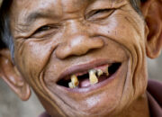 Buka Mata! Arti Mimpi Gigi Ompong Bagian Atas Depan  yang Perlu Diketahui