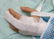 Misteri Terungkap: Arti Mimpi Jari Tangan Putus : Ini Penjelasannya