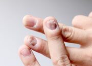 Misteri Terungkap: Arti Mimpi Kuku Lepas : Pertanda Baik atau Buruk? Kuak Misterinya!