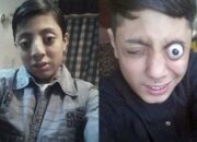 Penafsiran Unik: Arti Mimpi Mata Copot Sebelah : Pertanda Baik atau Buruk? Kuak Misterinya!