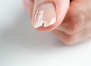 Kenali Arti Mimpi Kuku Patah : Pertanda Baik atau Buruk? Kuak Misterinya!