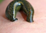 Kenali Arti Mimpi Digigit Pacet Seluruh Tubuh Ternyata Ini Artinya Menurut Pakar