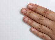 Wah, Arti Mimpi Tangan Putus Sebelah Kiri  yang Perlu Diketahui