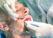 Misteri Terungkap: Arti Mimpi Mencabut Gigi Temukan Makna Rahasianya Disini