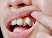 Kisah di Balik Arti Mimpi Gigi Lepas Bagian Atas : Pertanda Baik atau Buruk? Kuak Misterinya!