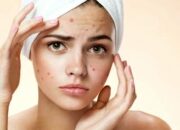 Buka Mata! Arti Mimpi Wajah Berjerawat Ternyata Ini Artinya Menurut Pakar