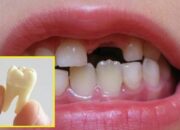 Penafsiran Unik: Arti Mimpi Gigi Lepas Temukan Makna Rahasianya Disini