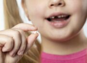 Tabir Terbuka:Rahasia Tersembunyi: Arti Mimpi Gigi Copot 2 : Ini Penjelasannya