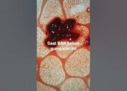 Simak! Arti Mimpi Keluar Gumpalan Darah Dari Kemaluan Ternyata Ini Artinya Menurut Pakar