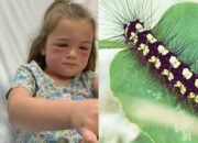 Tabir Terbuka:Rahasia Tersembunyi: Arti Mimpi Dikerumuni Ulat Bulu Temukan Makna Rahasianya Disini