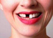 Misteri Terungkap: Arti Mimpi Gigi Copot 3 Temukan Makna Rahasianya Disini