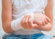 Kenali Arti Mimpi Tangan Patah : Ini Penjelasannya