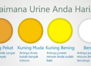 10 Jenis Warna Urine dan Artinya untuk Kesehatan Tubuh