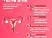 5 Langkah Penting untuk Mencegah Kanker Serviks: Perlindungan Dini untuk Kesehatan Anda!