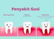 10 Penyakit Gigi dan Mulut yang Sering Ditemui dan Cara Pencegahannya!