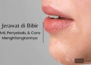 Arti Jerawat Tepat di Bibir Bawah Menurut Primbon: Ramalan dan Pertanda