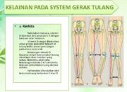 10 Penyakit Kelainan pada Sistem Gerak dan Cara Penanganannya