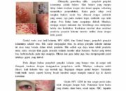 10 Jenis Penyakit Kelamin: Gejala