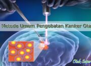 3 Hal yang Dapat Dilakukan untuk Pengobatan Kanker Otak: Pilihan dan Peluang